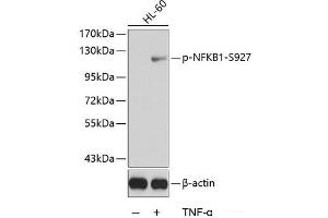 Western blot analysis of extracts from HL60 cells using Phospho-NFKB1(S927) Polyclonal Antibody. (NFKB1 antibody  (pSer927))