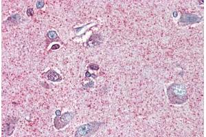 Brain, cortex, Human: Formalin-Fixed, Paraffin-Embedded (FFPE) (NTSR2 antibody  (Internal Region))