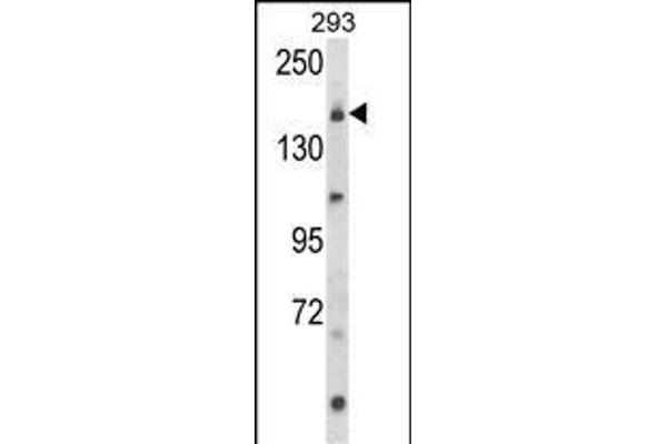 UNC13B Antikörper  (AA 1062-1091)