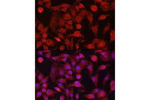 Immunofluorescence analysis of A-549 cells using R Rabbit pAb (ABIN6132924, ABIN6146720, ABIN6146721 and ABIN6214772) at dilution of 1:100 (40x lens). (RASGRP1 antibody  (AA 598-797))