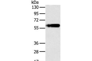 Western Blot analysis of Human fat tissue using PLIN1 Polyclonal Antibody at dilution of 1:200 (PLIN1 antibody)