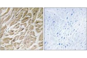 Immunohistochemistry analysis of paraffin-embedded human heart tissue, using MRPS24 Antibody. (MRPS24 antibody  (AA 51-100))