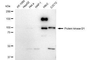 Western blotting analysis using Protein kinase D1 antibody (ABIN7800004).