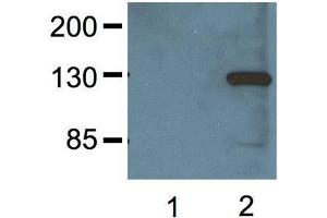 1:000 (1μg/mL) Ab dilution probed against HEK293 cells transfected with V5-tagged protein vector, untransfected (1) and transfected (2) (V5 Epitope Tag antibody)