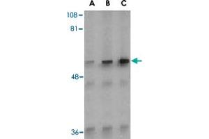 Western blot analysis of Irak2 in A-20 whole cell lysate with Irak2 polyclonal antibody  at (A) 0. (IRAK2 antibody  (C-Term))