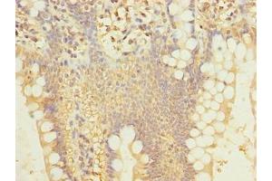 Immunohistochemistry of paraffin-embedded human small intestine tissue using ABIN7169695 at dilution of 1:100 (SIPA1L2 antibody  (AA 522-778))