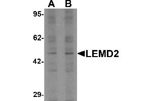 Western blot analysis of LEMD2 in 293 cell lysate with LEMD2 antibody at (A) 1 and (B) 2 µg/mL. (LEMD2 antibody  (Middle Region))