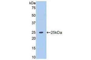 Detection of Recombinant MMP13, Human using Polyclonal Antibody to Matrix Metalloproteinase 13 (MMP13) (MMP13 antibody  (AA 103-290))