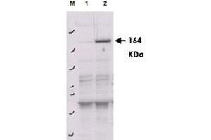Western blot using ROCK2 (phospho Y256) polyclonal antibody  shows detection of phosphorylated ROCK2 in transfected 293T cells. (ROCK2 antibody  (pTyr256))