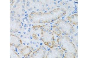 Immunohistochemistry of paraffin-embedded Mouse kidney using ASB4 Polyclonal Antibody at dilution of 1:100 (40x lens). (ASB4 antibody)