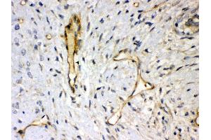 Anti- Syndecan 4 Picoband antibody, IHC(P) IHC(P): Human Mammary Cancer Tissue