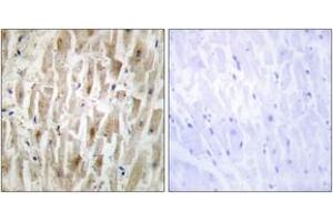 Immunohistochemistry (IHC) image for anti-LIM Domain Kinase 2 (LIMK2) (AA 461-510) antibody (ABIN2889517) (LIMK2 antibody  (AA 461-510))