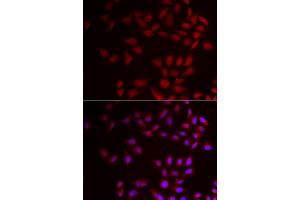 Immunofluorescence analysis of HeLa cells using CIRBP antibody (ABIN5973938). (CIRBP antibody)