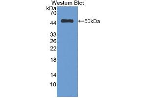 WB of Protein Standard: different control antibodies against Highly purified E. (SERPINC1 CLIA Kit)