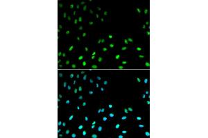 Immunofluorescence analysis of MCF-7 cells using RFC1 antibody. (RFC1 antibody)