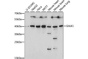 Western blot analysis of extracts of various cell lines, using G antibody (ABIN7267328) at 1:1000 dilution. (GALK1 antibody  (AA 1-120))