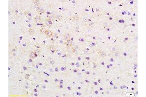 Formalin-fixed and paraffin embedded rat brain tissue labeled with Anti-ARHGAP32 Polyclonal Antibody, Unconjugated  at 1:200 followed by conjugation to the secondary antibody and DAB staining (ARHGAP32 antibody  (AA 860-896))