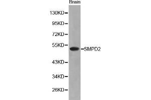 Western Blotting (WB) image for anti-Sphingomyelin phosphodiesterase 2, Neutral Membrane (Neutral Sphingomyelinase) (SMPD2) (AA 150-250) antibody (ABIN3021605) (SMPD2 antibody  (AA 150-250))
