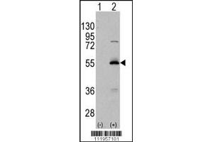 Western blot analysis of ALDH6A1 using rabbit polyclonal ALDH6A1 Antibody using 293 cell lysates (2 ug/lane) either nontransfected (Lane 1) or transiently transfected with the ALDH6A1 gene (Lane 2).
