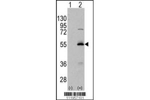 Western blot analysis of ALDH6A1 using rabbit polyclonal ALDH6A1 Antibody using 293 cell lysates (2 ug/lane) either nontransfected (Lane 1) or transiently transfected with the ALDH6A1 gene (Lane 2). (ALDH6A1 antibody  (C-Term))