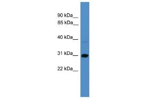 WB Suggested Anti-SERPINB8 Antibody Titration: 0. (SERPINB8 antibody  (C-Term))