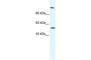 Western Blotting (WB) image for anti-DNA Helicase B (HELB) antibody (ABIN2461363) (DNA Helicase B antibody)