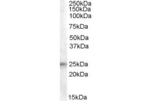 Image no. 1 for anti-Insulin-Like Growth Factor Binding Protein 6 (IGFBP6) (Internal Region) antibody (ABIN374965)