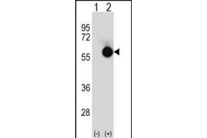 Western blot analysis of CTBP2 (arrow) using rabbit polyclonal CTBP2 Antibody (N-term) (ABIN656828 and ABIN2846037). (CTBP2 antibody  (N-Term))