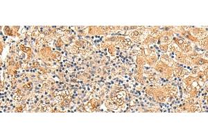 GPD1L antibody