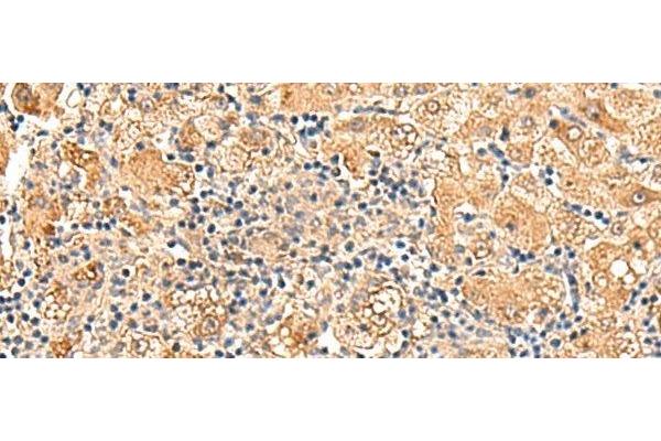 GPD1L antibody