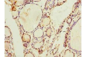 Immunohistochemistry of paraffin-embedded human thyroid tissue using ABIN7143477 at dilution of 1:100 (ARL11 antibody  (AA 2-196))