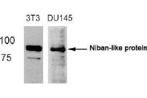 Image no. 2 for anti-Family with Sequence Similarity 129, Member B (FAM129B) (Ser712) antibody (ABIN319365) (MEG3 antibody  (Ser712))