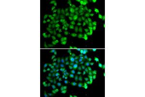 Immunofluorescence (IF) image for anti-Apolipoprotein B mRNA Editing Enzyme, Catalytic Polypeptide-Like 3C (APOBEC3C) antibody (ABIN1980244) (APOBEC3C antibody)