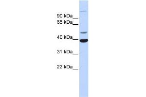 WB Suggested Anti-ZNF124 Antibody Titration:  0. (ZNF124 antibody  (Middle Region))