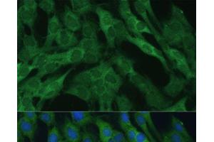 Immunofluorescence analysis of C6 cells using IDH1 Polyclonal Antibody at dilution of 1:100 (40x lens). (IDH1 antibody)