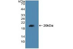 Detection of Recombinant PPARd, Human using Polyclonal Antibody to Peroxisome Proliferator Activated Receptor Delta (PPARd) (PPARD antibody  (AA 260-426))