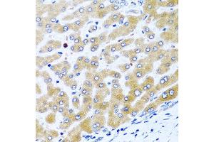 Immunohistochemistry of paraffin-embedded human liver using CCL21 antibody at dilution of 1:100 (40x lens). (CCL21 antibody)