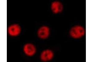 ABIN6277580 staining  HeLa cells by IF/ICC. (DP1 antibody  (C-Term))