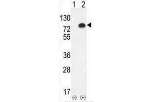 Western blot analysis of GPC6 (arrow) using rabbit polyclonal GPC6 Antibody (C-term) .