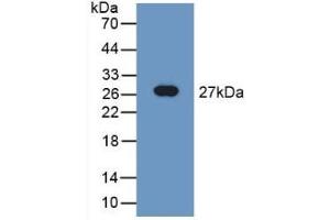 Detection of Recombinant TUBd, Rat using Polyclonal Antibody to Tubulin Delta (TUBd)