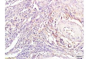 Formalin-fixed and paraffin embedded human endometrial tissue labeled with Anti-Tuberin/TSC2 Polyclonal Antibody, Unconjugated (ABIN701200) at 1:300, followed by conjugation to the secondary antibody and DAB staining (Tuberin antibody  (AA 1601-1750))