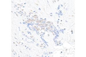 anti-Chromodomain Helicase DNA Binding Protein 8 (CHD8) (AA 2252-2302) antibody