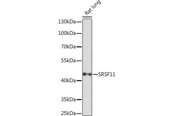 SRSF11 antibody