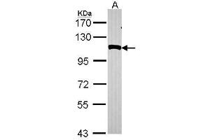 WB Image Sample (30 ug of whole cell lysate) A: Hela 7. (NPEPPS antibody)