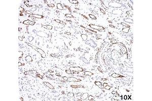 IHC testing of FFPE human kidney transplant tissue (10X) stained with C4d antibody (C4D204). (Complement C4d antibody)