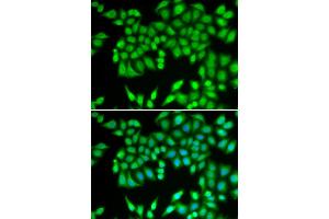 Immunofluorescence analysis of U2OS cells using MCM3 antibody (ABIN5970419). (MCM3 antibody)