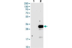 Western blot analysis of Lane 1: Negative control (vector only transfected HEK293T lysate), Lane 2: Over-expression Lysate (Co-expressed with a C-terminal myc-DDK tag (~3. (DTD1 antibody)