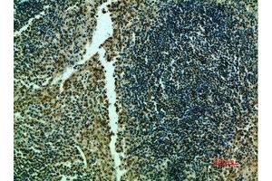 Immunohistochemical analysis of paraffin-embedded human-tonsils, antibody was diluted at 1:200 (TERT antibody  (AA 1268-1341))