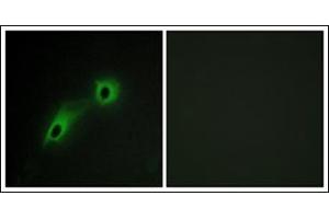Immunofluorescence analysis of HeLa cells, using CAMK5 Antibody.