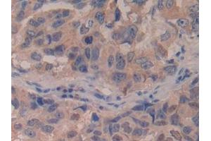 Immunohistochemistry (IHC) image for anti-Interferon, beta 1, Fibroblast (IFNB1) (AA 22-187) antibody (ABIN7431356)